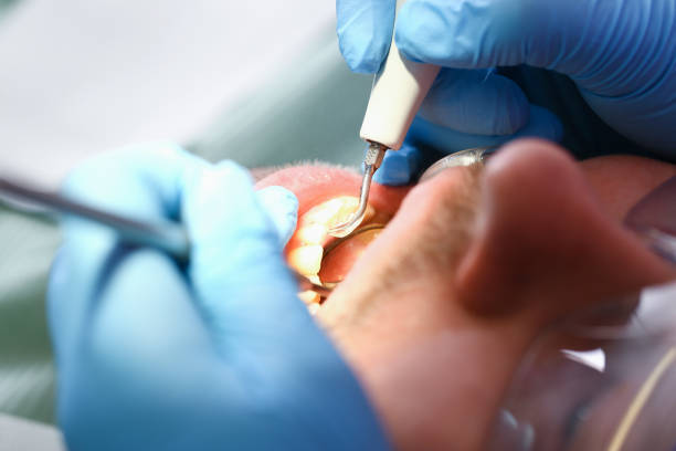 Best Dental Abscess Treatment in Bradley, WV